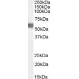 Western Blot - Anti-Glucose 6 Phosphate Dehydrogenase Antibody (A83368) - Antibodies.com