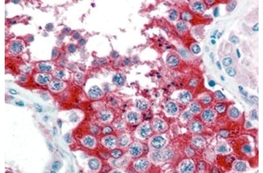 Immunohistochemistry - Anti-Glucose 6 Phosphate Dehydrogenase Antibody (A83368) - Antibodies.com