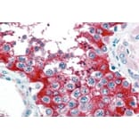 Immunohistochemistry - Anti-Glucose 6 Phosphate Dehydrogenase Antibody (A83368) - Antibodies.com