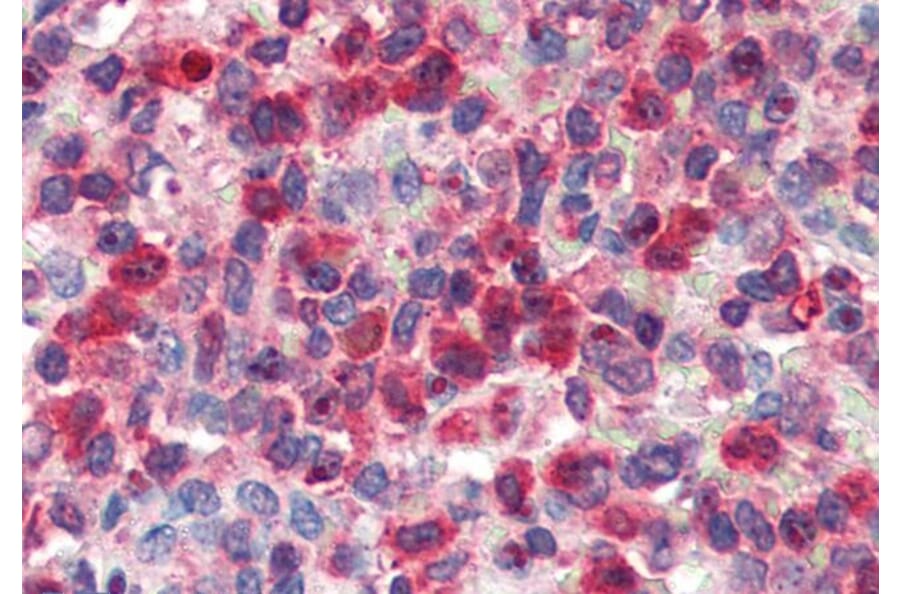 Immunohistochemistry - Anti-Glucose 6 Phosphate Dehydrogenase Antibody (A83368) - Antibodies.com