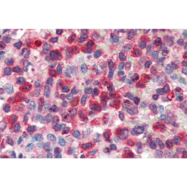 Immunohistochemistry - Anti-Glucose 6 Phosphate Dehydrogenase Antibody (A83368) - Antibodies.com
