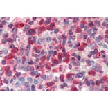 Immunohistochemistry - Anti-Glucose 6 Phosphate Dehydrogenase Antibody (A83368) - Antibodies.com