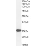Western Blot - Anti-PAX6 Antibody (A83369) - Antibodies.com