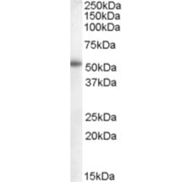 Western Blot - Anti-Aromatase Antibody (A83370) - Antibodies.com