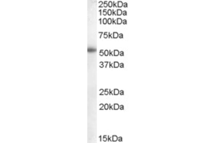 Western Blot - Anti-Aromatase Antibody (A83370) - Antibodies.com