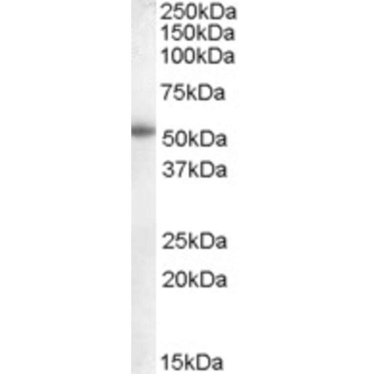 Western Blot - Anti-Aromatase Antibody (A83370) - Antibodies.com