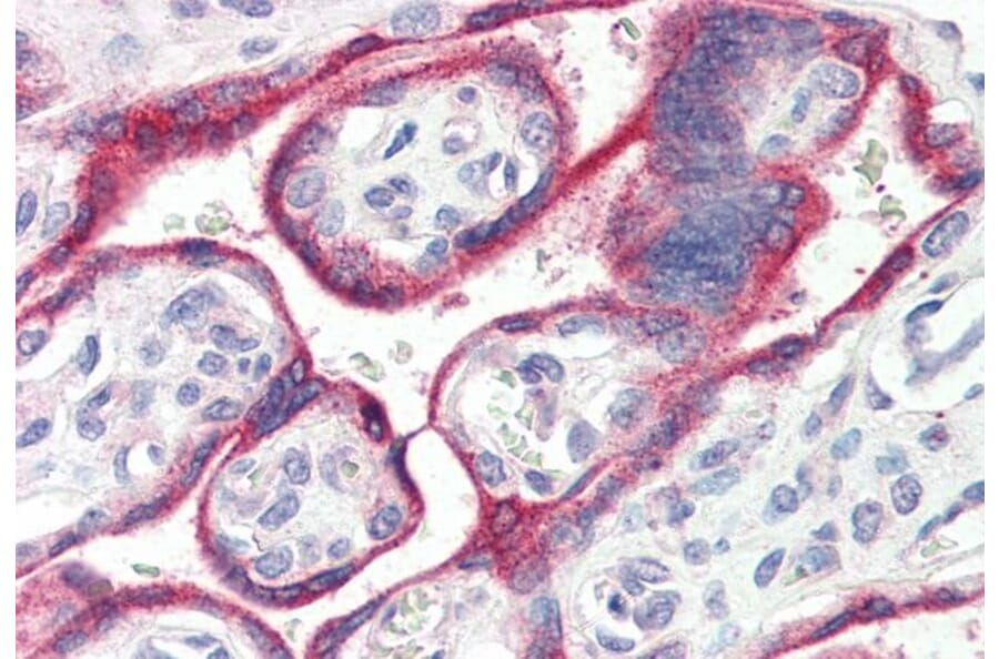 Immunohistochemistry - Anti-Aromatase Antibody (A83370) - Antibodies.com