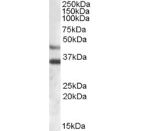 Western Blot - Anti-ARSB Antibody (A83371) - Antibodies.com