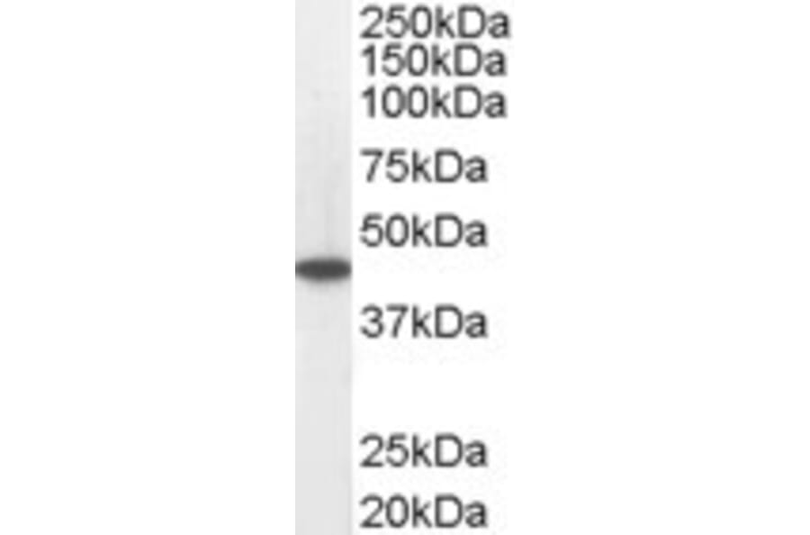 Western Blot - Anti-ACADM/MCAD Antibody (A83372) - Antibodies.com