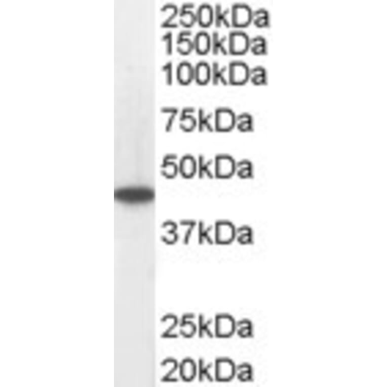 Western Blot - Anti-ACADM/MCAD Antibody (A83372) - Antibodies.com