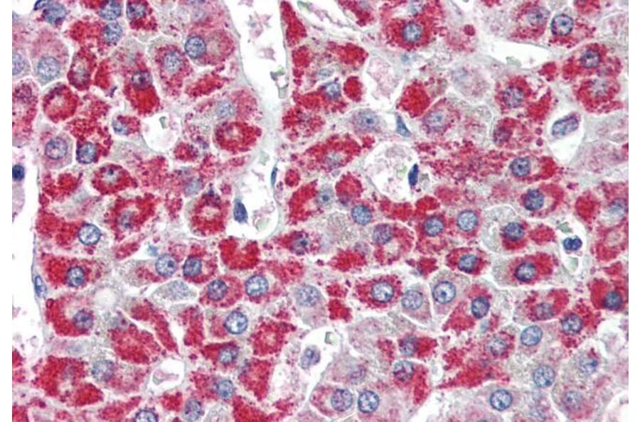 Immunohistochemistry - Anti-ACADM/MCAD Antibody (A83372) - Antibodies.com