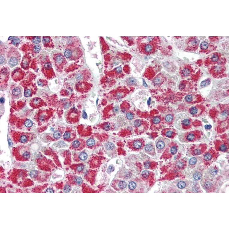 Immunohistochemistry - Anti-ACADM/MCAD Antibody (A83372) - Antibodies.com