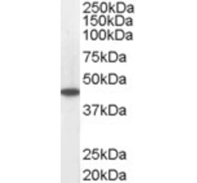 Western Blot - Anti-ACADM Antibody (A83372)