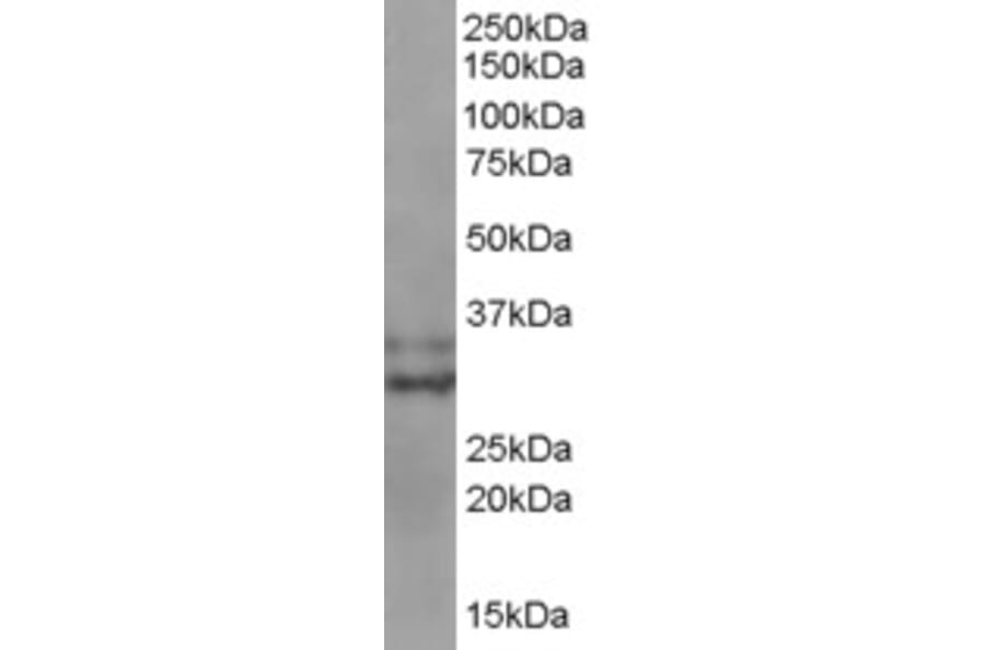 Western Blot - Anti-Livin Antibody (A83374) - Antibodies.com