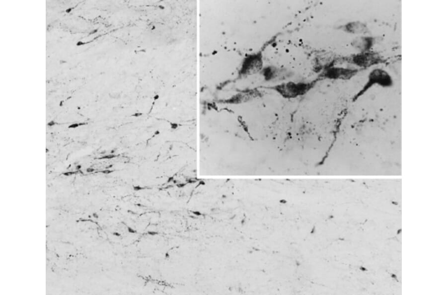 Immunohistochemistry - Anti-AGRP Antibody (A83375) - Antibodies.com