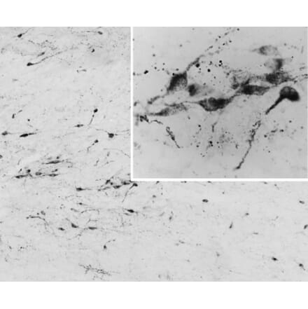 Immunohistochemistry - Anti-AGRP Antibody (A83375) - Antibodies.com