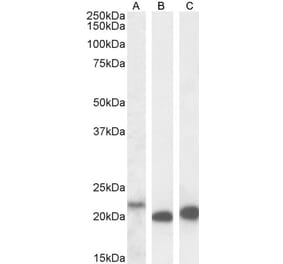 Western Blot - Anti-IL-18 Antibody (A83377) - Antibodies.com