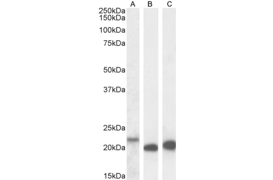 Western Blot - Anti-IL-18 Antibody (A83377) - Antibodies.com