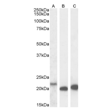 Western Blot - Anti-IL-18 Antibody (A83377) - Antibodies.com