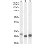 Western Blot - Anti-IL-18 Antibody (A83377) - Antibodies.com