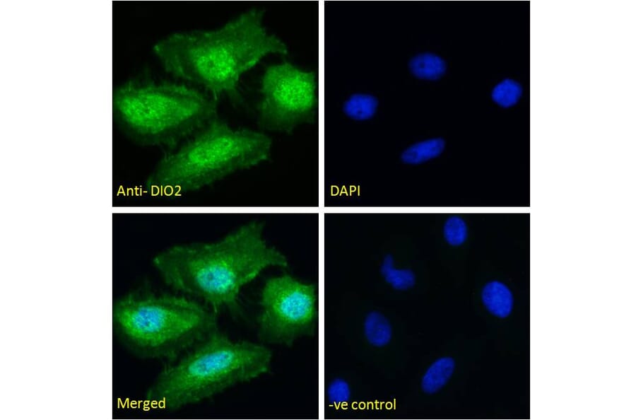 Immunofluorescence - Anti-DIO2 Antibody (A83378) - Antibodies.com