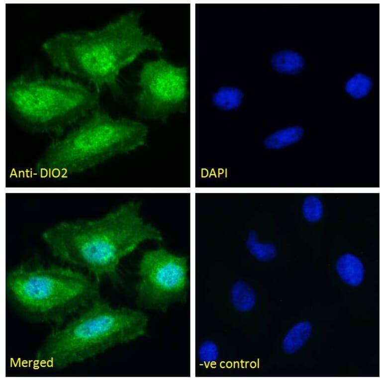 Immunofluorescence - Anti-DIO2 Antibody (A83378) - Antibodies.com