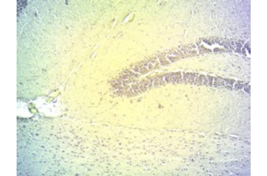 Immunohistochemistry - Anti-DIO2 Antibody (A83378) - Antibodies.com