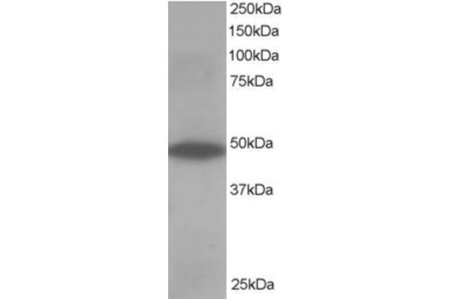 Western Blot - Anti-ORP1 Antibody (A83379) - Antibodies.com