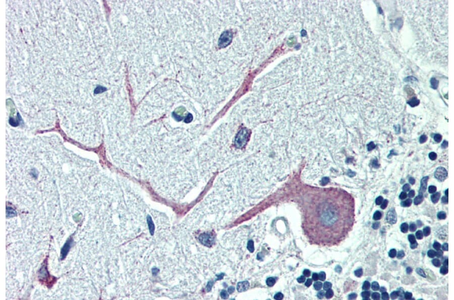 Immunohistochemistry - Anti-ORP1 Antibody (A83379) - Antibodies.com