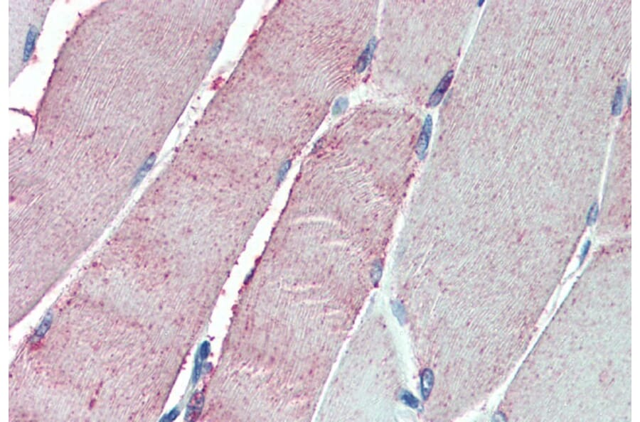 Immunohistochemistry - Anti-ORP1 Antibody (A83379) - Antibodies.com