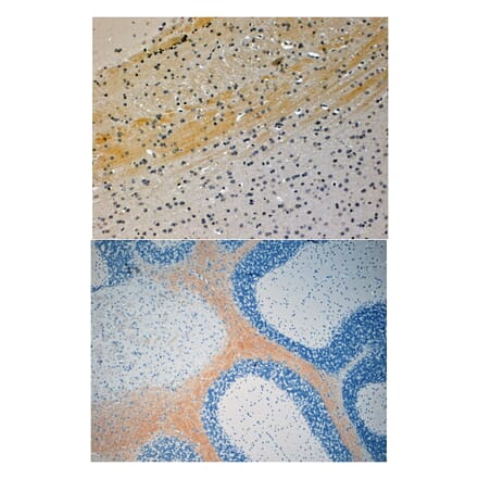 Immunohistochemistry - Anti-JIP3 Antibody (A83380) - Antibodies.com