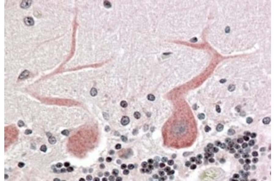 Immunohistochemistry - Anti-CDC42 Binding Protein Kinase alpha Antibody (A83382) - Antibodies.com