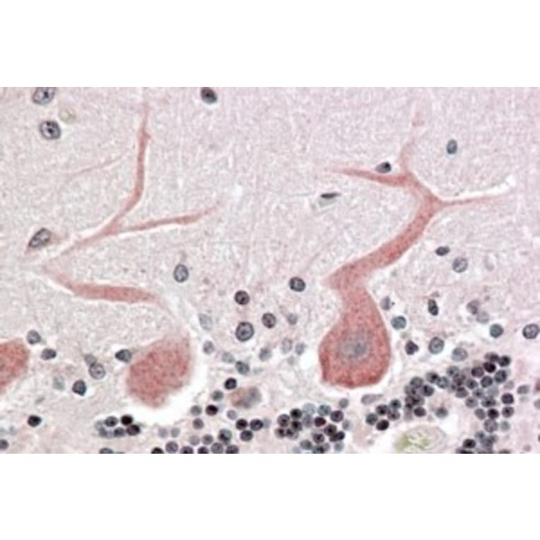 Immunohistochemistry - Anti-CDC42 Binding Protein Kinase alpha Antibody (A83382) - Antibodies.com
