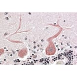 Immunohistochemistry - Anti-CDC42 Binding Protein Kinase alpha Antibody (A83382) - Antibodies.com