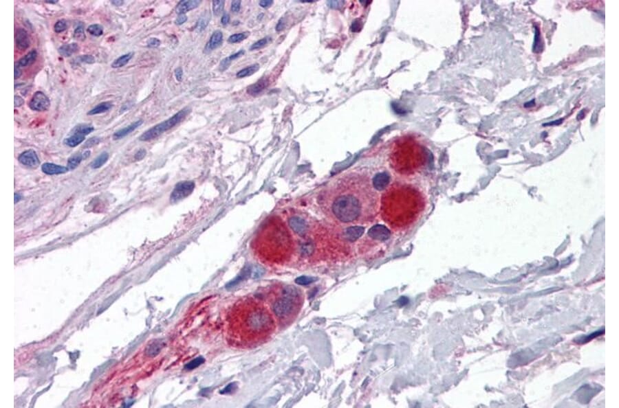 Immunohistochemistry - Anti-CDC42 Binding Protein Kinase alpha Antibody (A83382) - Antibodies.com