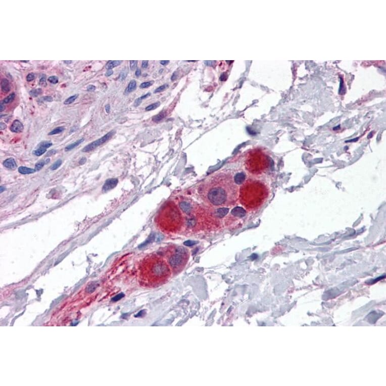 Immunohistochemistry - Anti-CDC42 Binding Protein Kinase alpha Antibody (A83382) - Antibodies.com