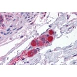 Immunohistochemistry - Anti-CDC42 Binding Protein Kinase alpha Antibody (A83382) - Antibodies.com