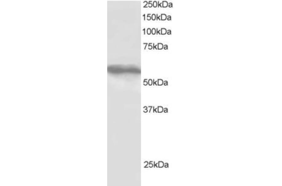 Western Blot - Anti-TRIM4 Antibody (A83384) - Antibodies.com