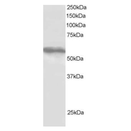 Western Blot - Anti-TRIM4 Antibody (A83384) - Antibodies.com