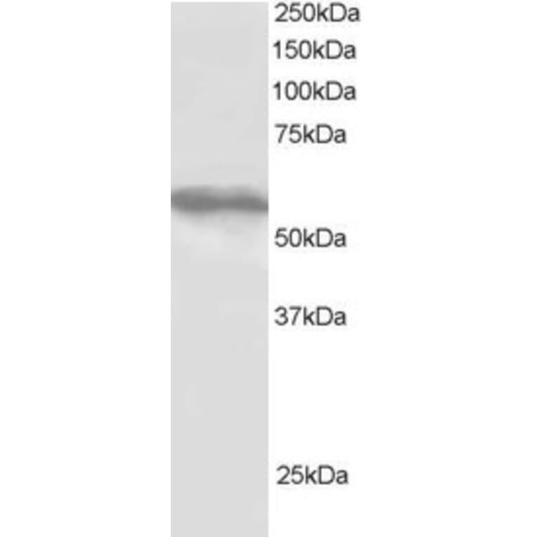 Western Blot - Anti-TRIM4 Antibody (A83384) - Antibodies.com