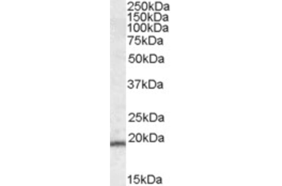 Western Blot - Anti-TMS1/ASC Antibody (A83386) - Antibodies.com