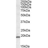 Western Blot - Anti-TMS1/ASC Antibody (A83386) - Antibodies.com