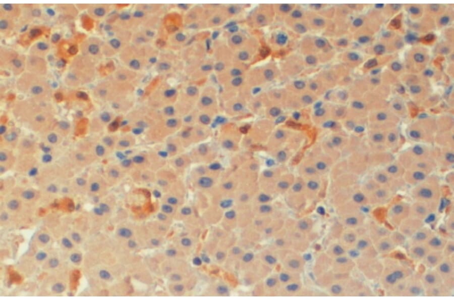 Immunohistochemistry - Anti-TMS1/ASC Antibody (A83386) - Antibodies.com