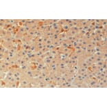 Immunohistochemistry - Anti-TMS1/ASC Antibody (A83386) - Antibodies.com