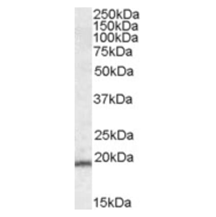 Western Blot - Anti-PYCARD Antibody (A83386)