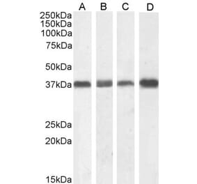 Western Blot - Anti-Nucleophosmin Antibody (A83388) - Antibodies.com