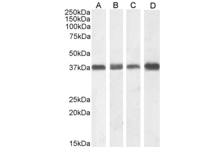 Western Blot - Anti-Nucleophosmin Antibody (A83388) - Antibodies.com