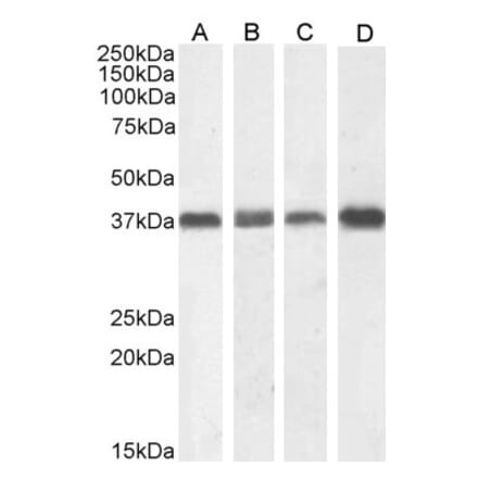 Western Blot - Anti-Nucleophosmin Antibody (A83388) - Antibodies.com