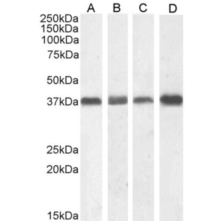 Western Blot - Anti-Nucleophosmin Antibody (A83388) - Antibodies.com