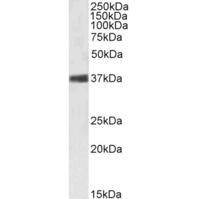 Western Blot - Anti-Nucleophosmin Antibody (A83388) - Antibodies.com